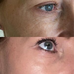 Jalpuro: before and after 05