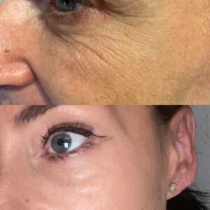 Jalpuro: before and after 04