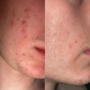 ZO skin programme 04