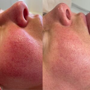 ZO skin programme 03