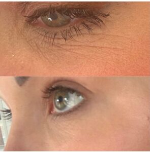 Jalpuro: before and after 03