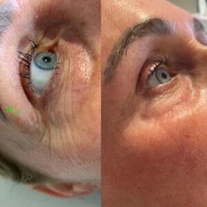 Jalpuro: before and after 02