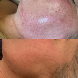 ZO skin programme 02