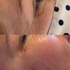 Jalpuro: before and after 01