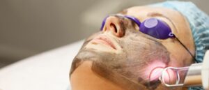 Skintec Carbon Facial treatment