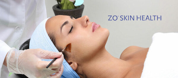 Skintec ZO chemical peel